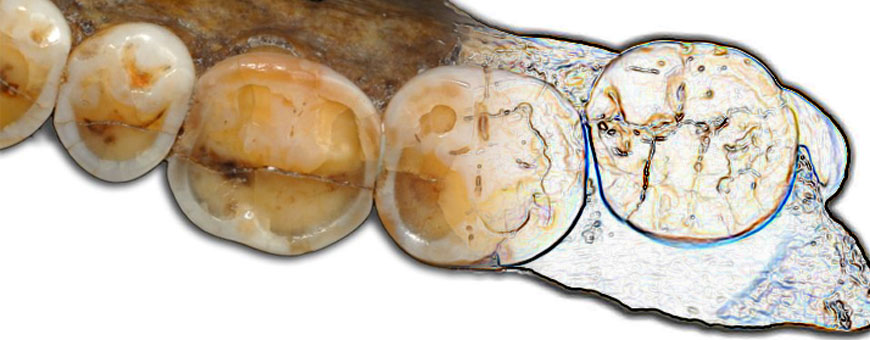 zubi neandertalca