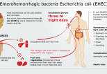 Dangerous enterohemorrhagic bacteria E. coli