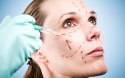 Plastic Surgeons Are Doing ‘Facebook Facelifts’