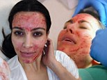 'I will never get a facelift' Kim vows to keep away from plastic surgery... and instead gets treated to a 'vampire facial' 