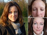 'When my eyebrows fell out I felt my life was over': Graduate, 34, whose brows went bald after Lupus says face tattoos saved her sanity