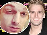 'I got my ass jumped last night': Aaron Carter posts a gnarly Instagram snap of his bruised hands and knuckles after allegedly being attacked in Boston because he was on 'New Kids On The Block turf'