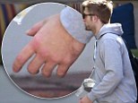 Did he get into a fight? Robert Pattinson sports swollen left hand and suspiciously dark eye while lunching in Los Angeles 