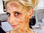 What happened to Sarah Michelle Gellar? Actress reveals bloody and scratched face (but it's all for her new television series The Crazy Ones) 