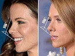 Experts have analysed what makes an ideal nasal and found the tip needs to be slightly upturned - just like the one natural beauty Kate has. Other examples of a perfect nose are those sported by fellow Brit beauty Kate Beckinsale and American actress Jessica Biel.

In a study revealed today scientists found the angle of rotation at the nasal tip should be exactly at 106 degrees to enhance a woman's femininity.

Dr Omar Ahmed, from New York University, said: "To our knowledge this is the first population-based study to attempt to simultaneously determine the ideal NTP - nasal tip projection - and rotation.

"A rotation of 106 degrees was found to be the most aesthetic."