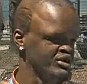 Taking legal action: Ectodermal dysplasia sufferer Jahmel Binion, 23 (pictured) is suing Shaquille O'Neal for ridiculing him online in April