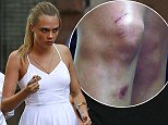 Cara Delevingne wears an all white dress whiile doing a photoshoot in NOHO, New York City. Cara can be seen being playful, and also with wound marks on her legs.

Pictured: Cara Delevingne
Ref: SPL834636  040914  
Picture by: Splash News

Splash News and Pictures
Los Angeles: 310-821-2666
New York: 212-619-2666
London: 870-934-2666
photodesk@splashnews.com