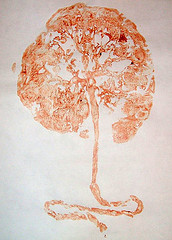 Placenta Art