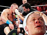 John Cena Broken Nose