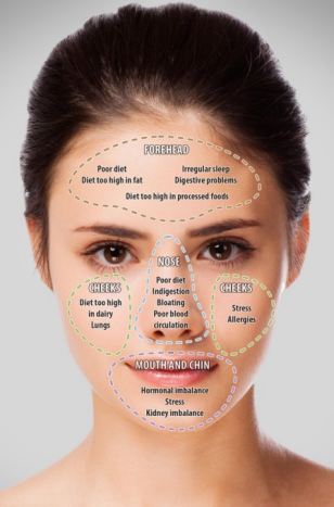 Face map your acne to reveal what the position of your blemishes says about YOU
