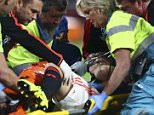 Medics prepare to carry Manchester Unitedís Luke Shaw off the pitch after being tackled by PSV's Hector Moreno, resulting in a double fracture of Shaw's right leg, during the Champions League Group B soccer match between PSV and Manchester United at Philips stadium in Eindhoven, Netherlands, Tuesday, Sept. 15, 2015. (AP Photo/Peter Dejong)