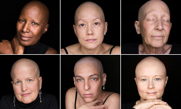 Robert Houser's portraits spotlight cancer patients as they reveal hair loss and scars