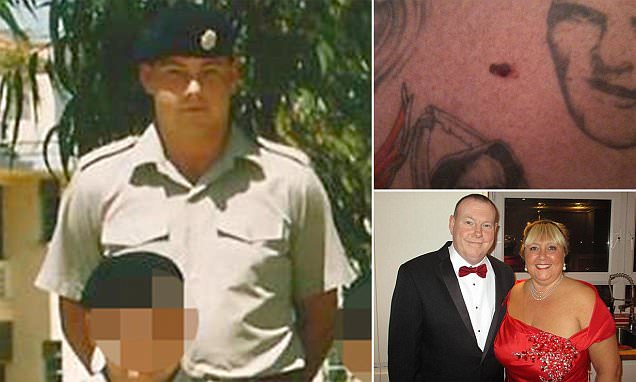 Former soldier Lee Hall claims cancer due Army never giving him sun cream
