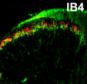 The cause of the itch? Scientists were able to identify the 'itch' cells, shown here lit up in mice