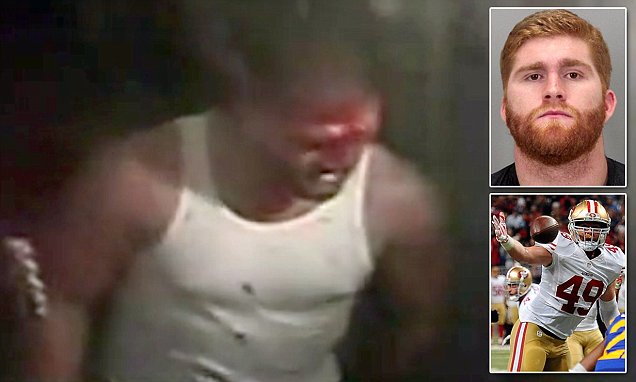 Surveillance footage shows 49ers tight end Bruce Miller bloodied and in drunken stupor