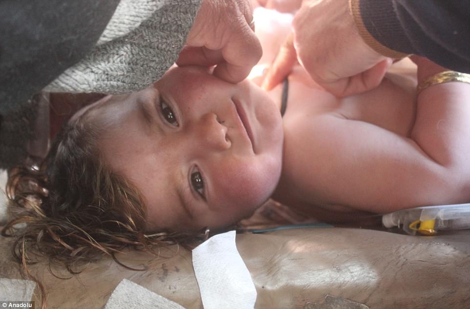 The government denies the use of chemical weapons and has in turn accused rebels of using banned weapons. Pictured above, a wounded kid receives treatment following the attach