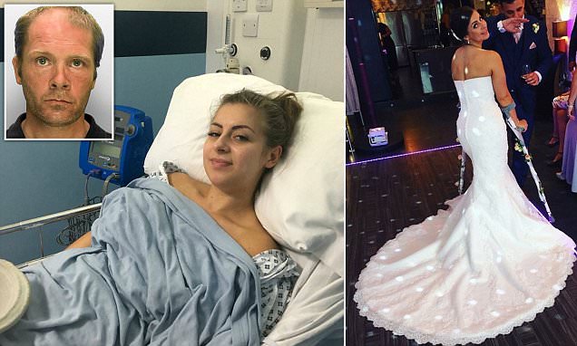 Thug broke bride's leg by with his remote controlled car