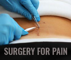 Surgery For Pain