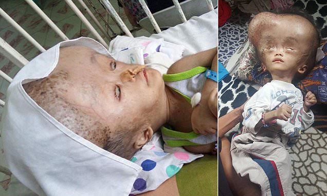 Good Samaritan raises funds for boy to have brain surgery