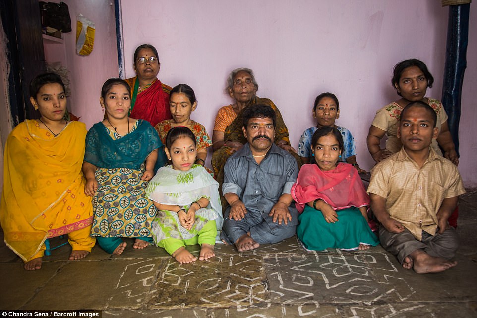 This family in the Indian city of Hyderabad always stands out in a crowd - because nine of the 11  members have dwarfism. Fifty-two-year-old Ram Raj Chauhan is the head of the family. Each member is affected by a genetic condition called Achondroplasia, which causes short-limbed dwarfism. Incredibly, Ram Raj's family once consisted of 21 people - 18 of whom had the condition