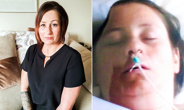 Mother, 35, reveals how she had half her SKULL removed after suffering a brain aneurysm