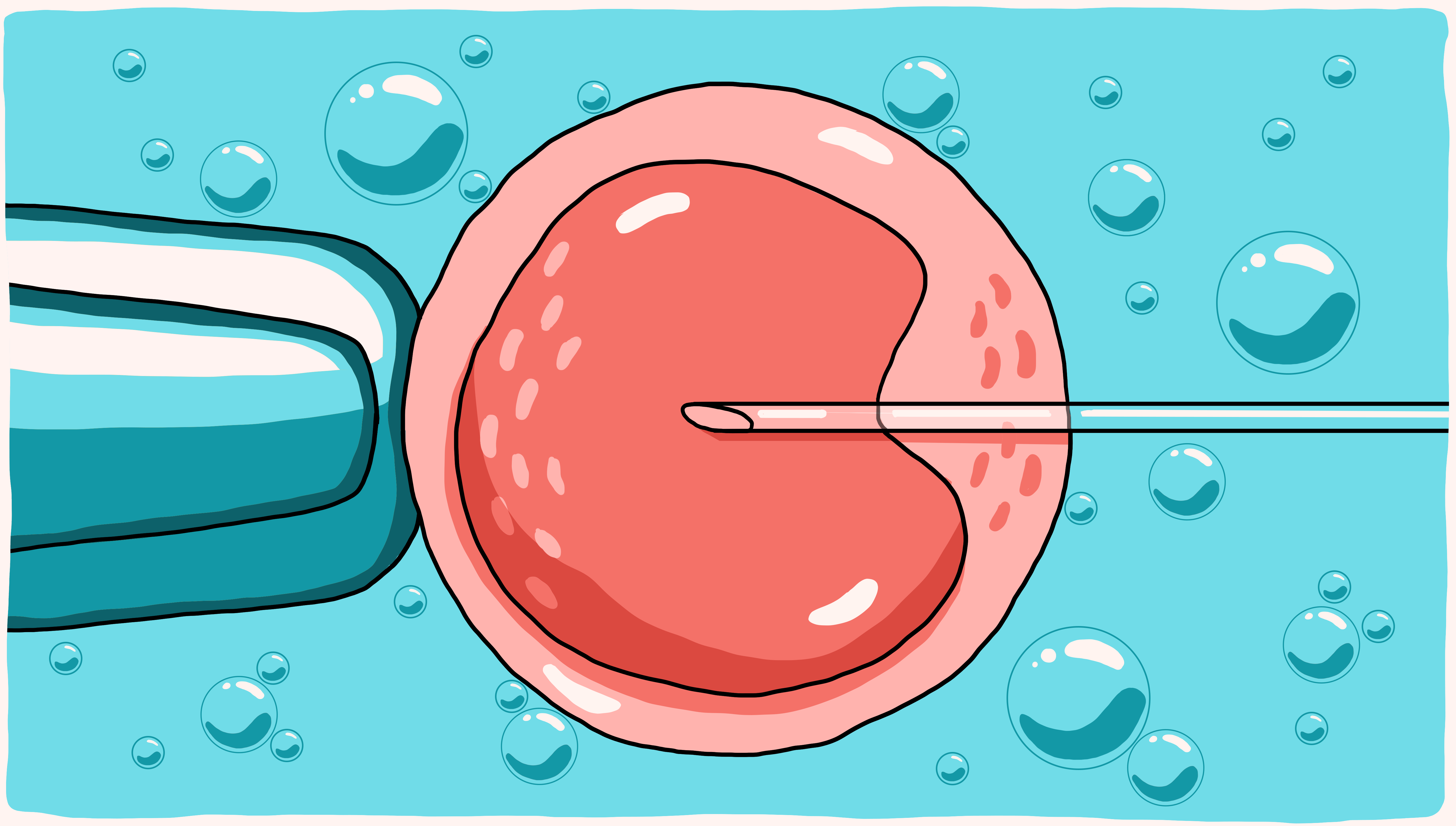 Illustration of a human egg being fertilized for IVF.