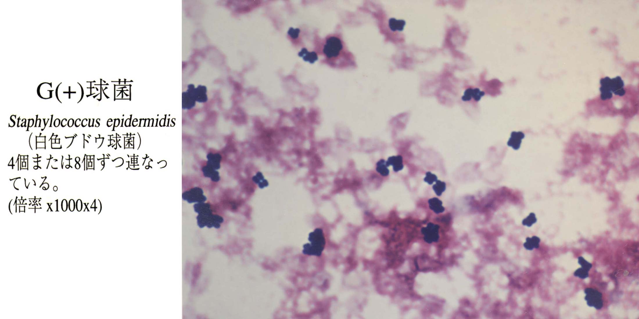 Staphylococcus aureus 4. Стафилококкус ауреус микроскопия. Эпидермальный стафилококк микроскопия. Эпидермический стафилококк. Staphylococcus aureus микроскопия.