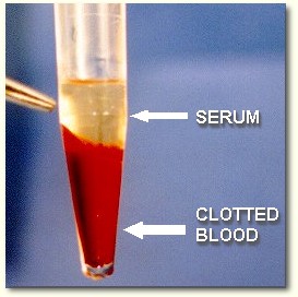 Serum for a blood chemistry profile.