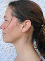 Maria After Facial Exercises (Left View)