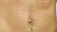Guess the celebrity abs