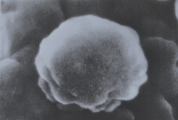 This image shows a magnified view of the AIDS virus taken by researchers in the medical department of Tokyo’s Tottori University. The photo, magnified 350,000 times, was taken with a scanning electron microscope. Researchers said the virus of the deadly disease has a rugged surface. Nearly 30 million people have died of AIDS since the first five cases were recognized in Los Angeles in 1981. About 34 million people have HIV now, including more than 1 million in the United States.