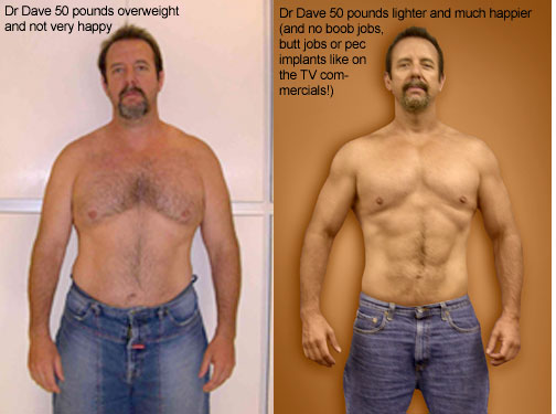Dr. Dave Woynarowski, before and after weight loss