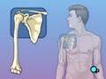 Description: PreOp® Patient Education: Shoulder Replacement Surgery