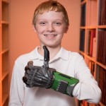 Colin Consavage with his 3-D printed prosthetic hand
