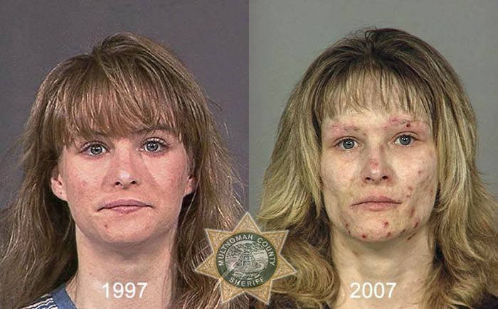drug_abusers_before_and_after_19