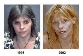 drug_abusers_before_and_after_27
