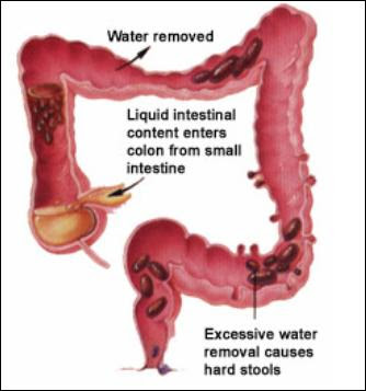 constipation+colon - Sembelit : Kesukaran Membuang Air Besar