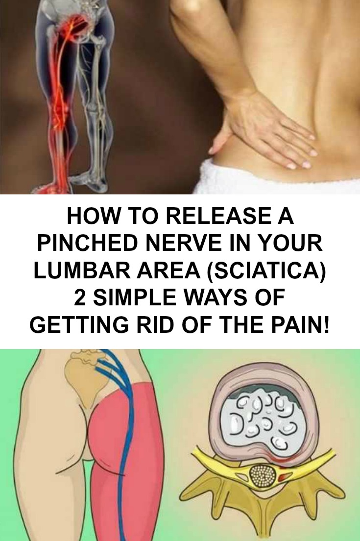 how-to-release-the-pinched-nerve-in-your-lumbar-area-sciatica