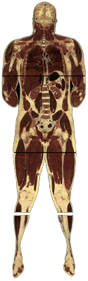 Cross-sections of the Visible Man