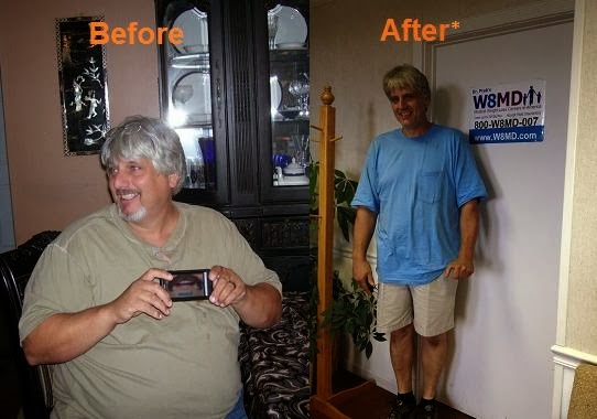 Before and after weight loss Philadelphia