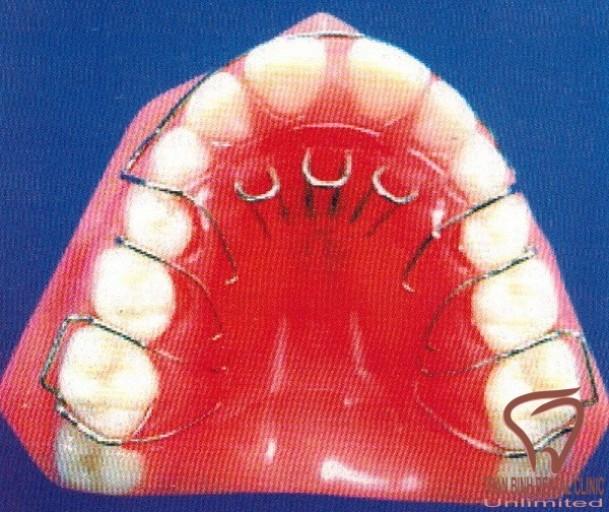 loại bỏ tật xấu răng miệng