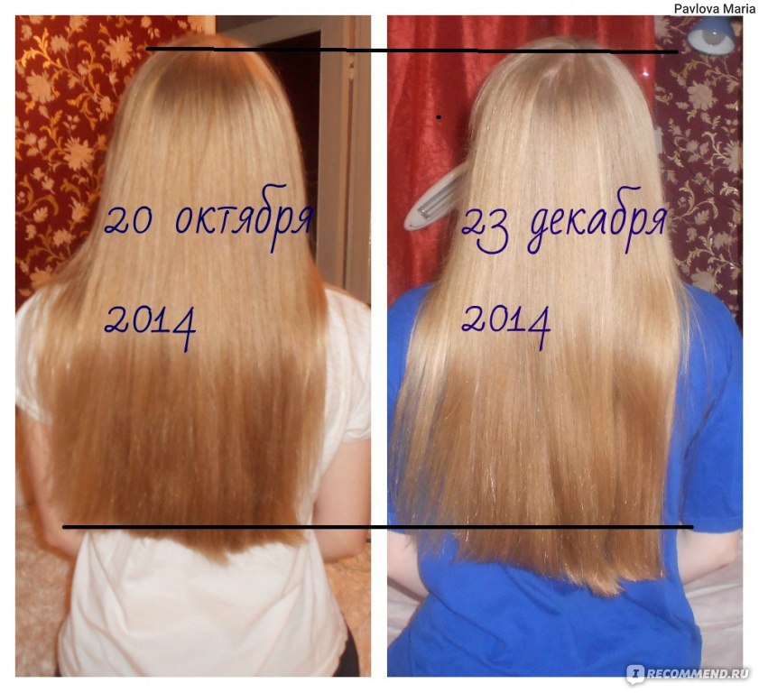 Сколько растут волосы на голове за месяц