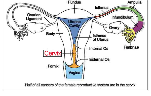 Drawing of the femalre reproductive system, focusing on the cervix.