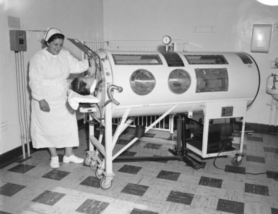 A patient in an emerson iron lung with a nurse standing beside the the machine